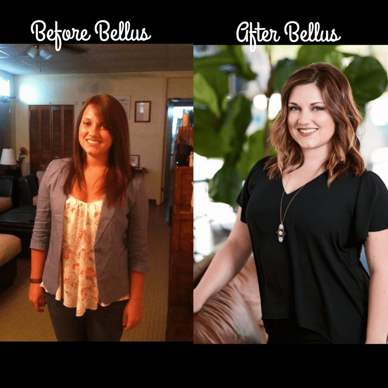 Bellus - Alexis Rodriguez before and after