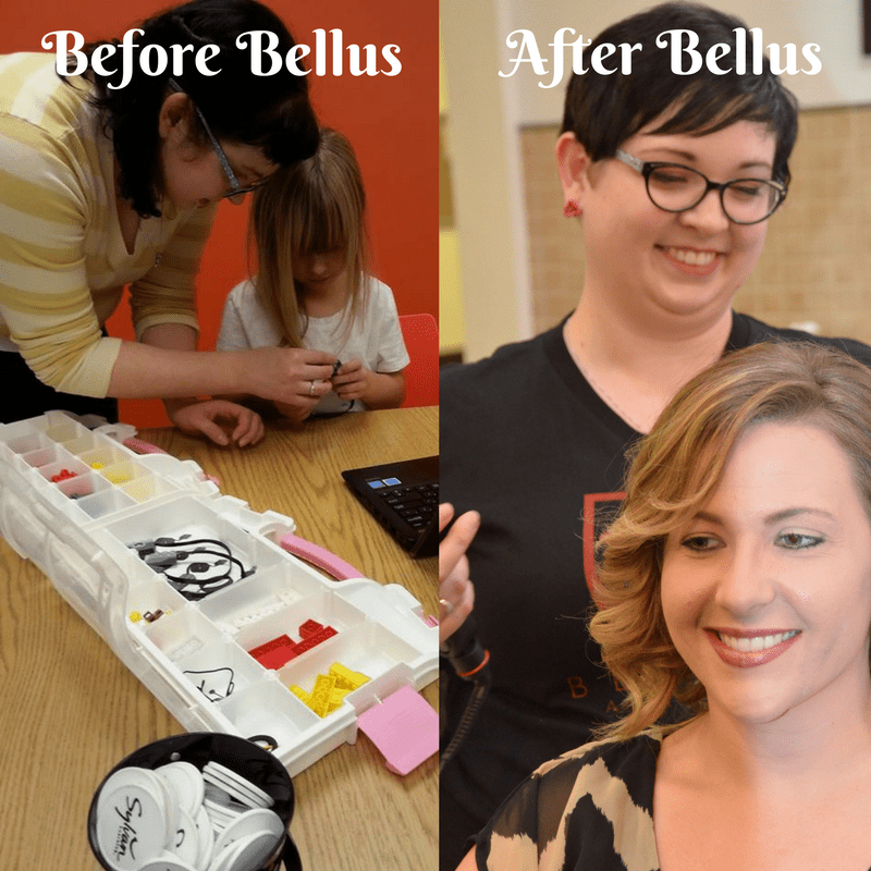 Bellus- Ashley before and after